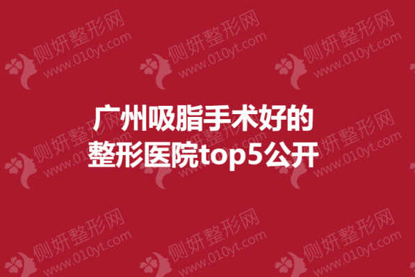 广州吸脂手术好的整形医院top5公开